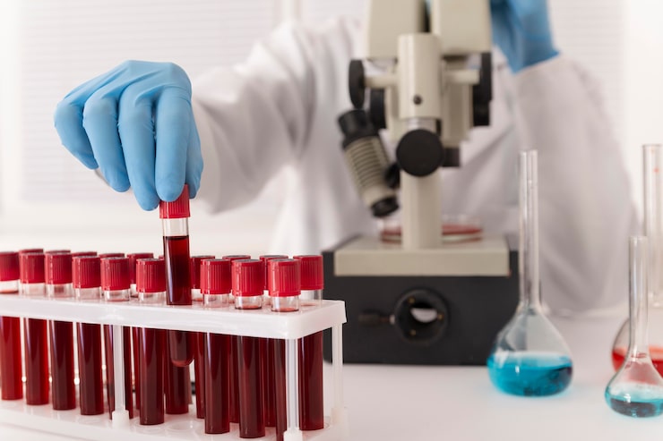 Gratis Foto koronavirus blodprøvearrangement i lab