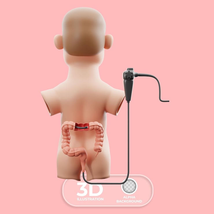 Gratis PSD koloskopi tarmundersøkelse 3d-illustrasjon