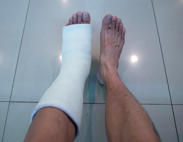 Foto gips
