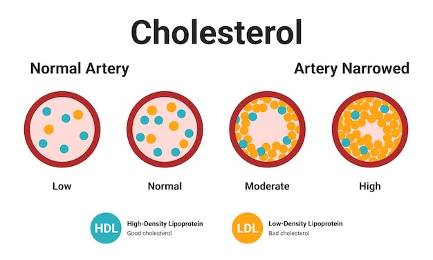 Vector soorten cholesterol_04