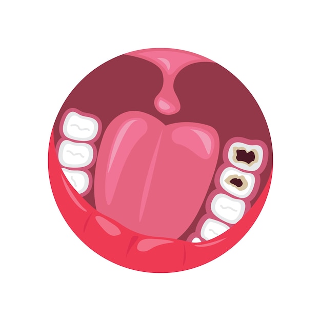 Vecteur cavité dans le modèle de conception de l'élément vectoriel de dessin animé de dent