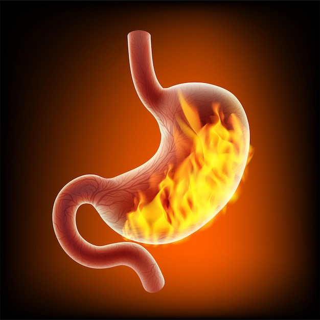 Vector stomach007